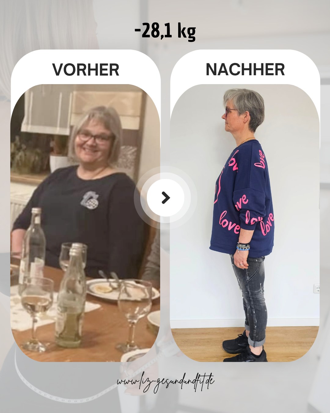Vorher-Nachher Foto Frontal